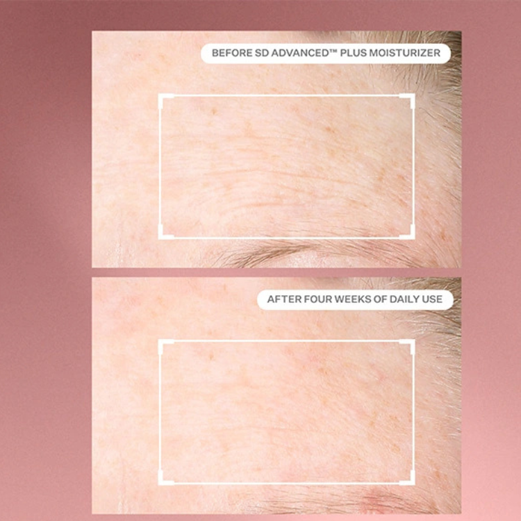 2Pk StriVectin SD Advanced Plus Intensive Moisturizer Concentrate - Image 7